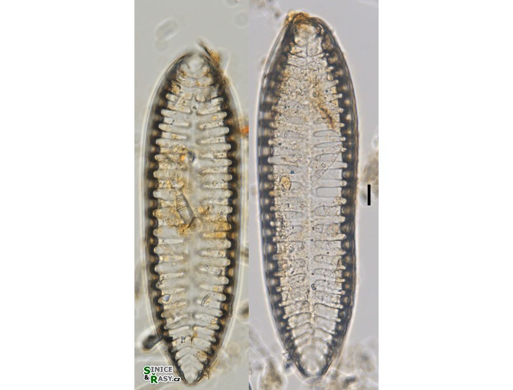 Surirella angusta