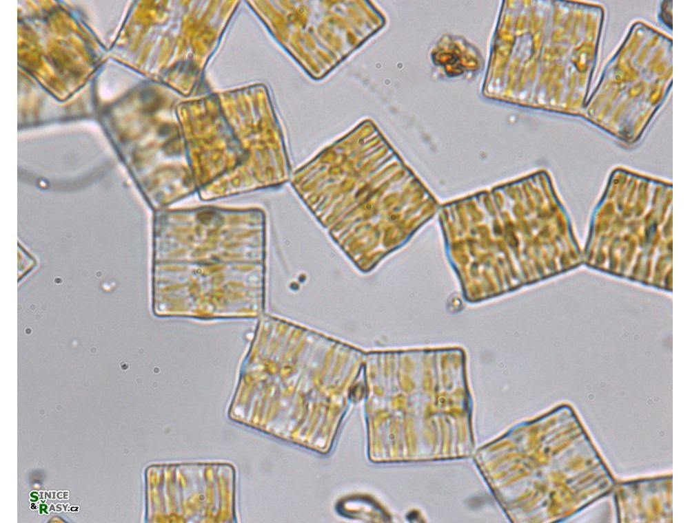 Tabellaria flocculosa