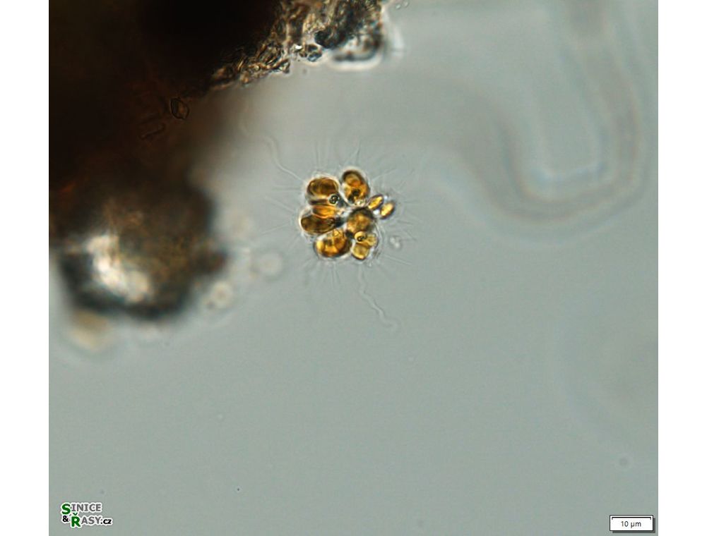 Chrysosphaerella