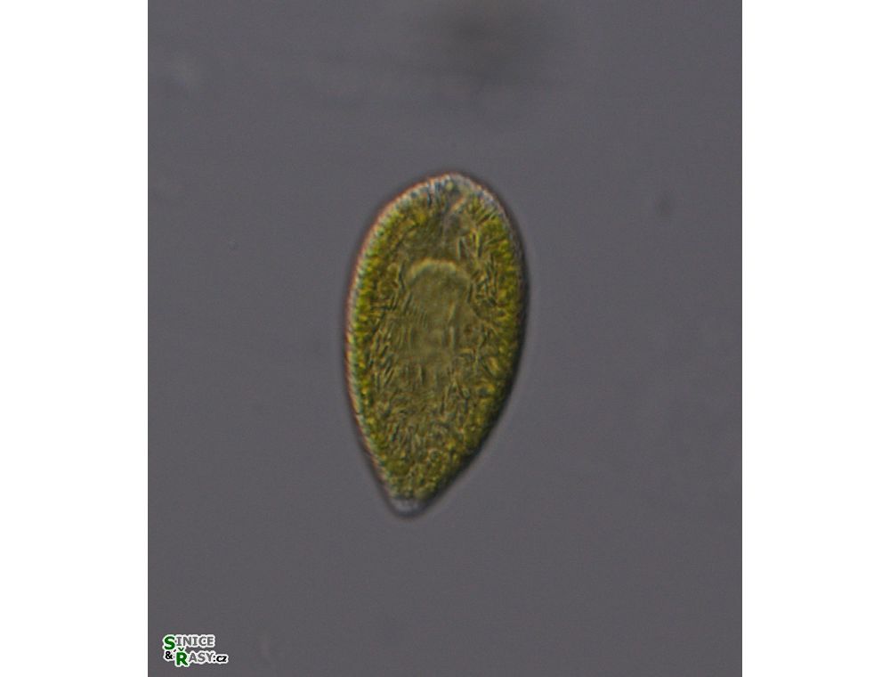 Gonyostomum semen