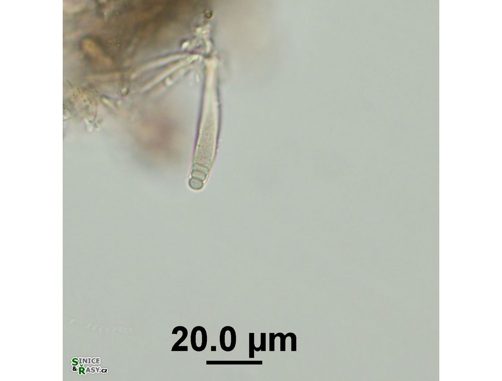 Chamaesiphon cenfervicola