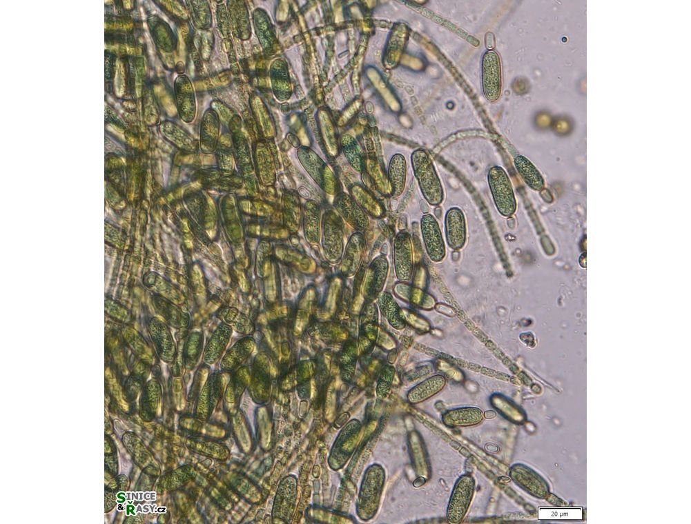 Cylindrospermum stagnale