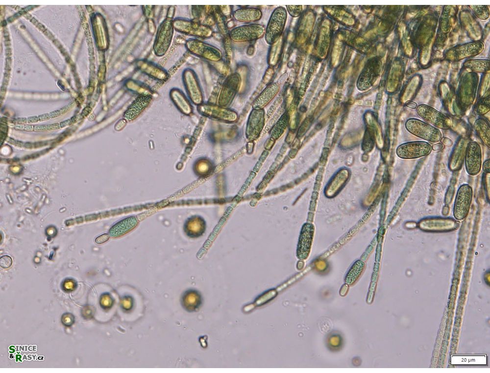 Cylindrospermum stagnale