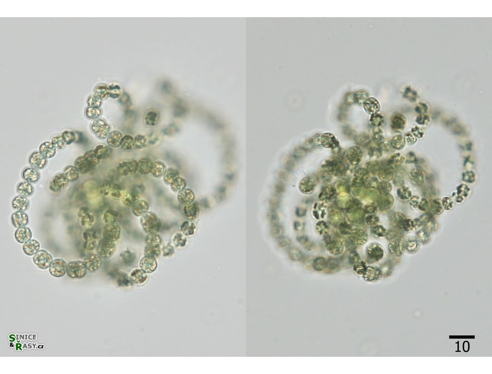 Dolichospermum lemmermanni