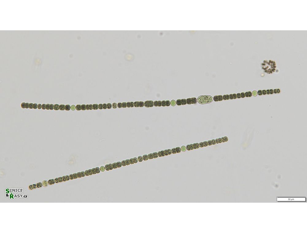 Dolichospermum planctonicum