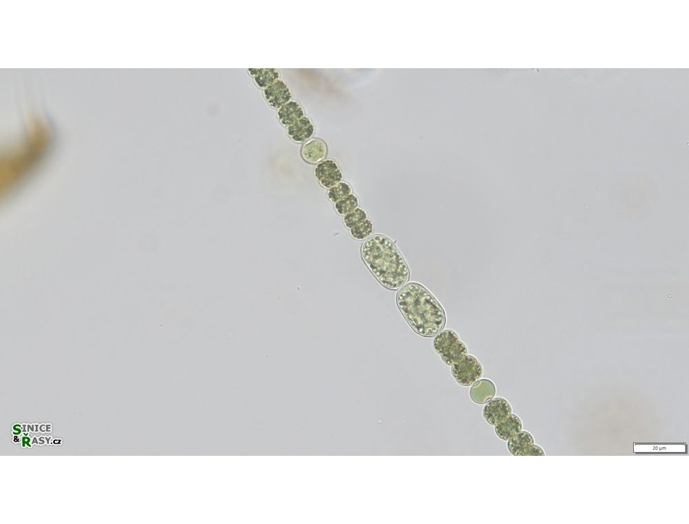 Dolichospermum planctonicum
