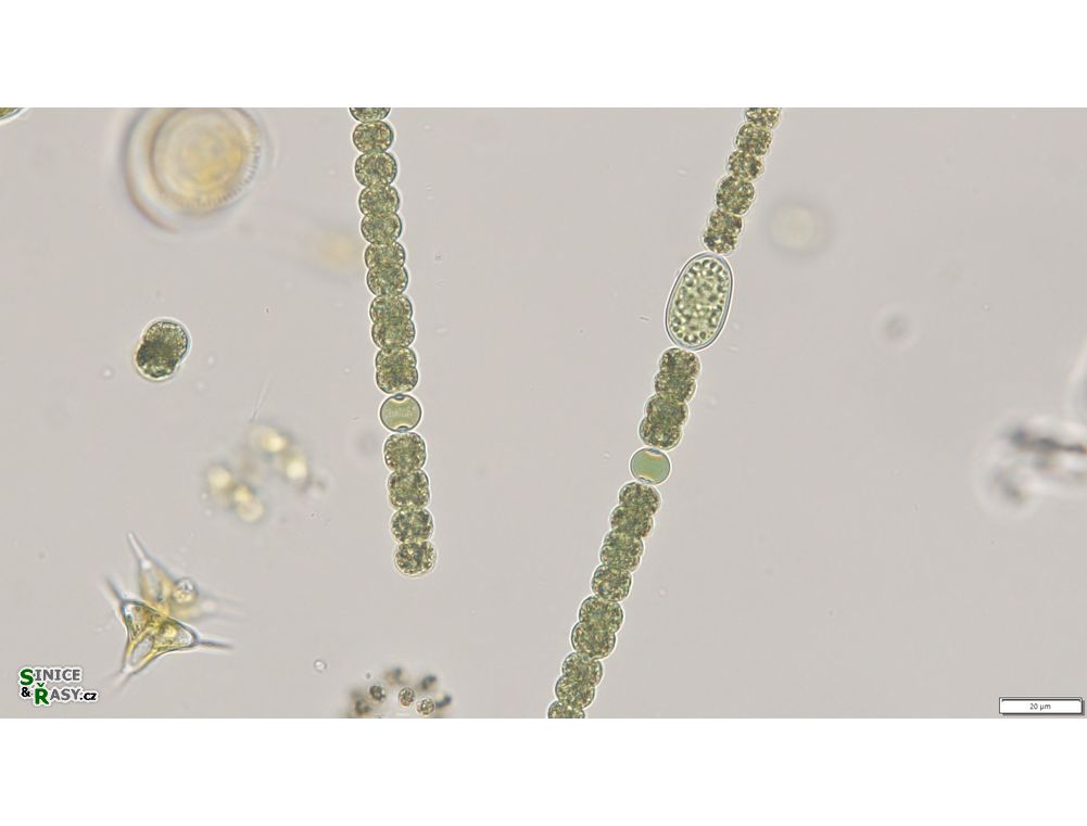 Dolichospermum planctonicum