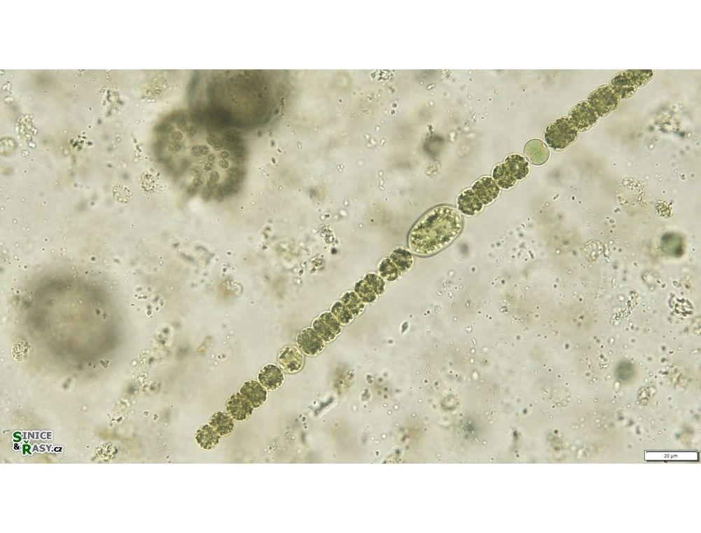 Dolichospermum planctonicum