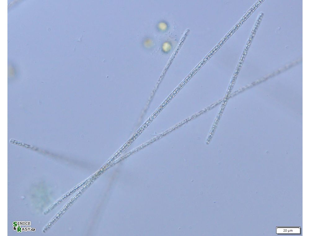 Planktothrix agardhii