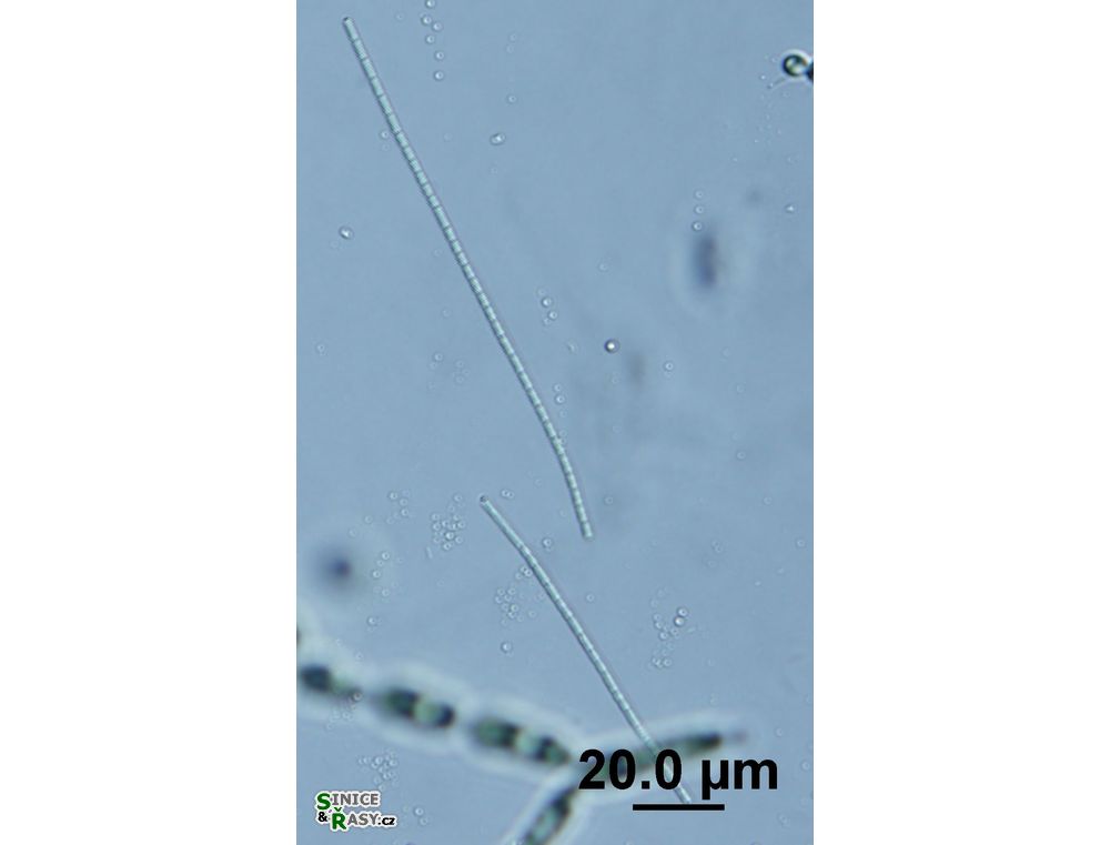 Pseudanabaena frigida