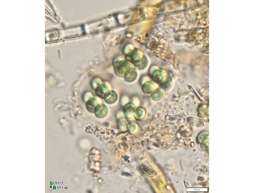 Eucapsis alpina