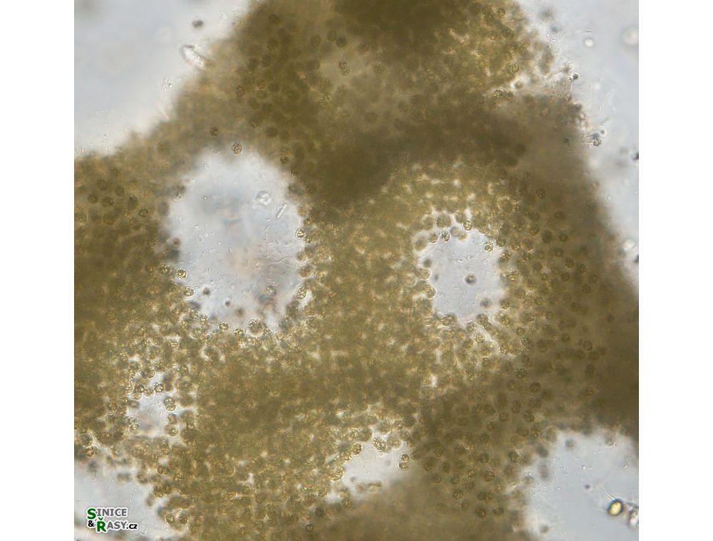 Microcystis aeruginosa