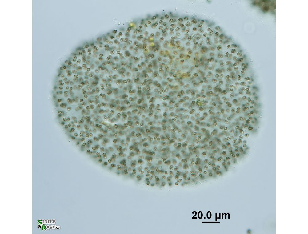 Microcystis flosaque