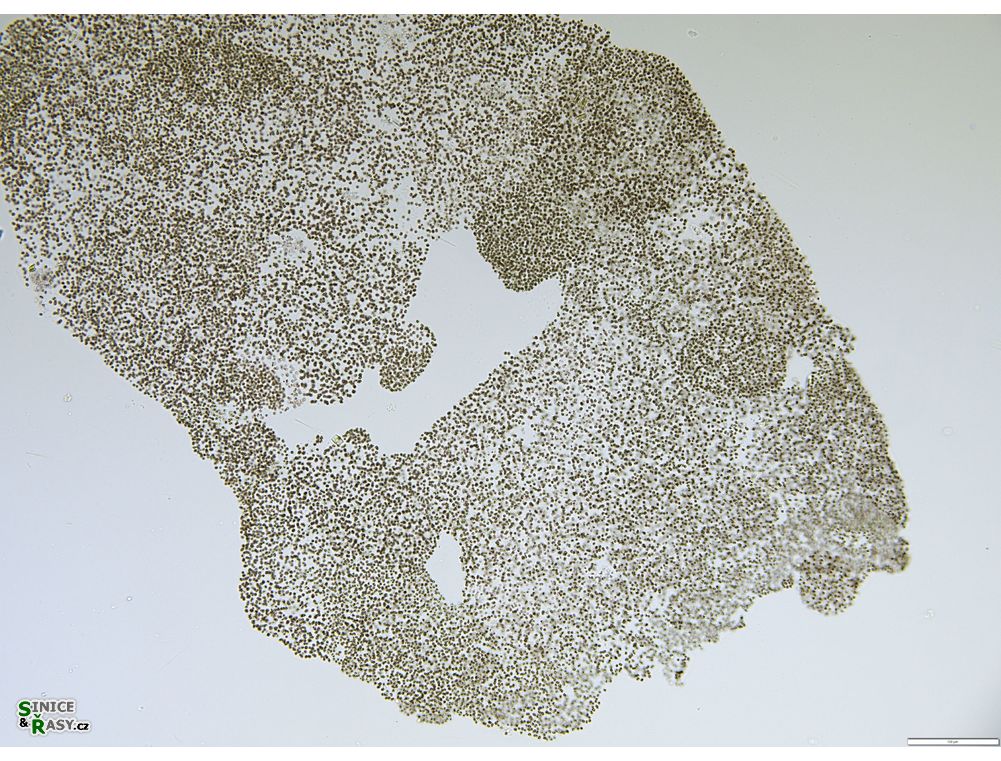 Microcystis microcystiformis