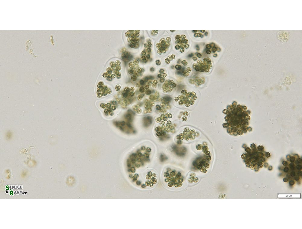 Microcystis wesenbergii