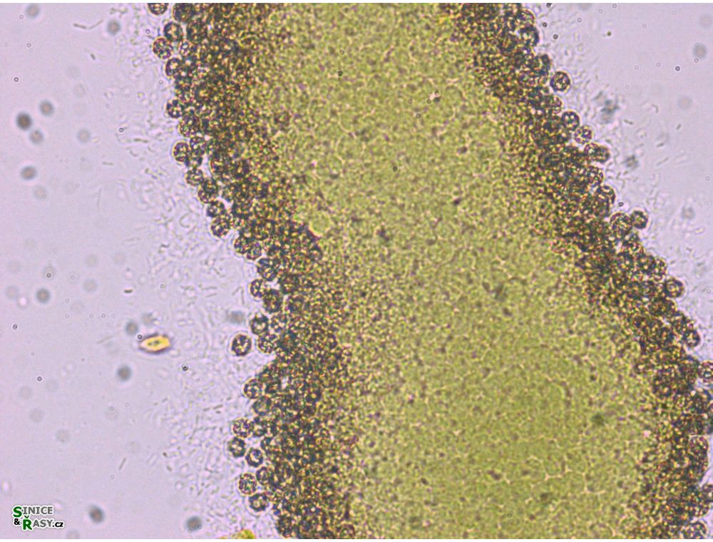 Synechococcus endobioticus