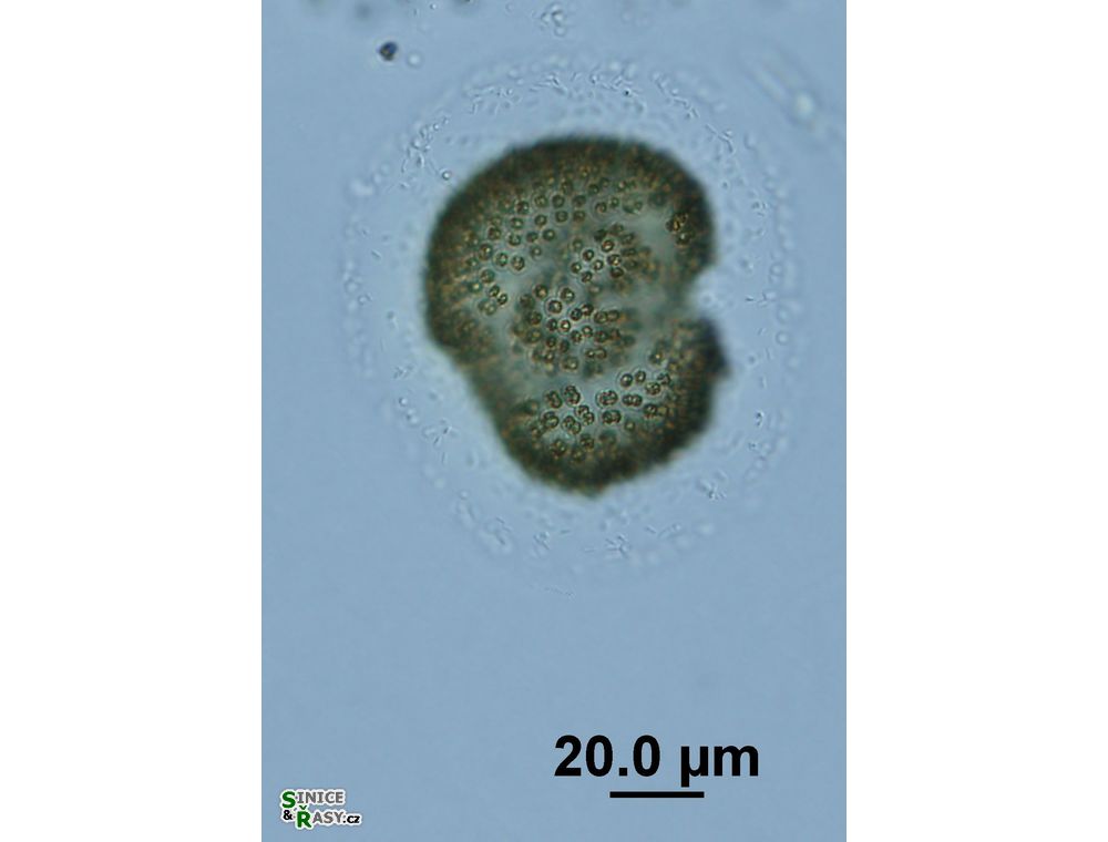Woronichinia naegeliana