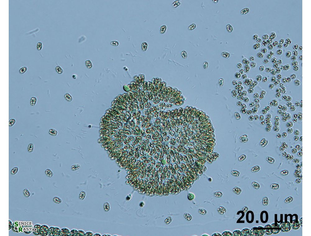 Woronichinia naegeliana
