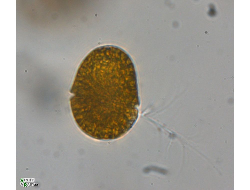 Gymnodinium uberrimum