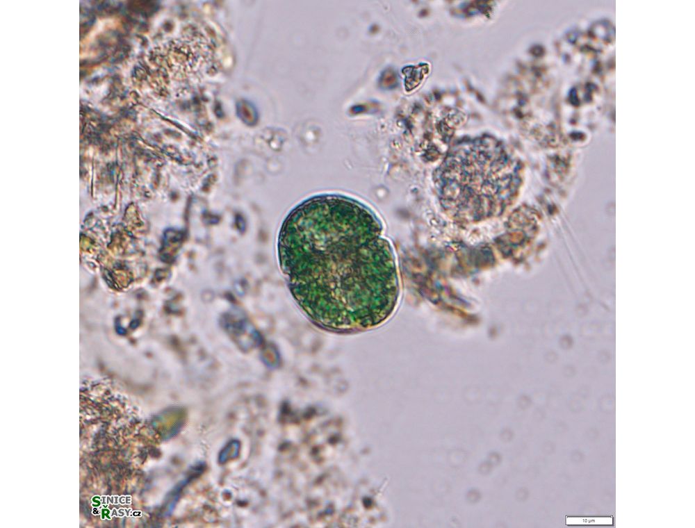 Nussutodinium aerugineum