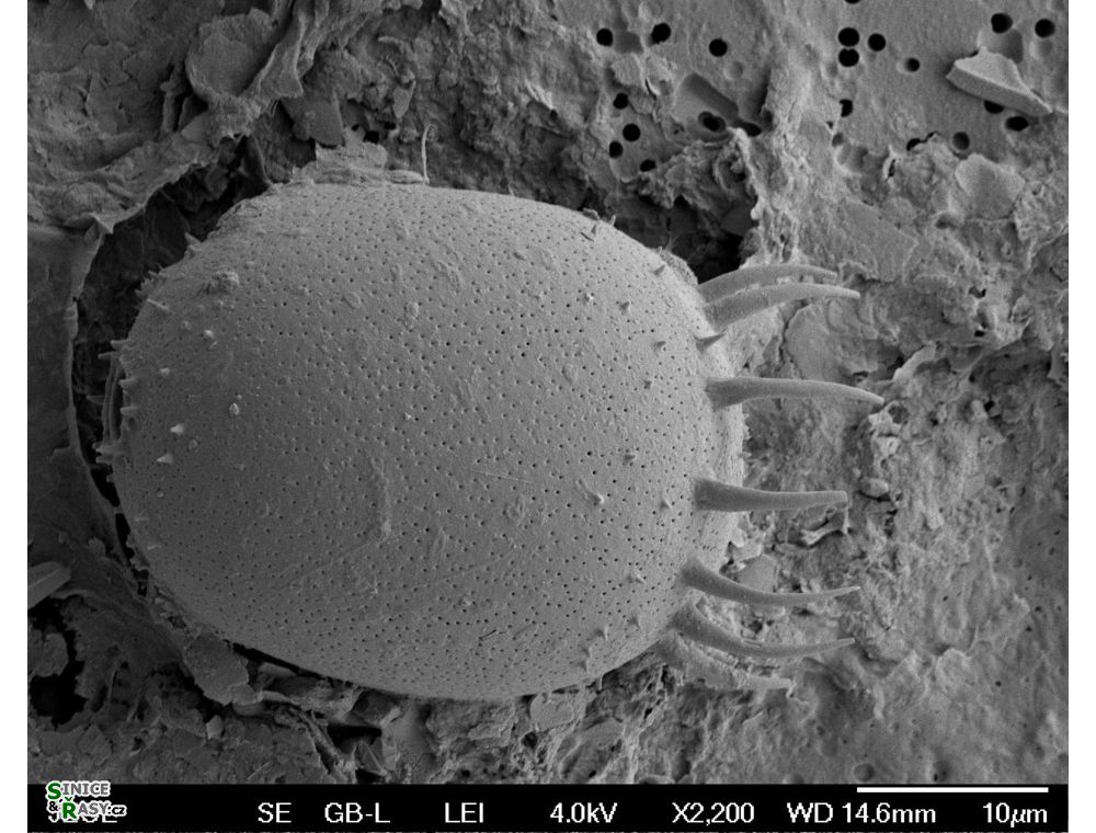 Trachelomonas armata