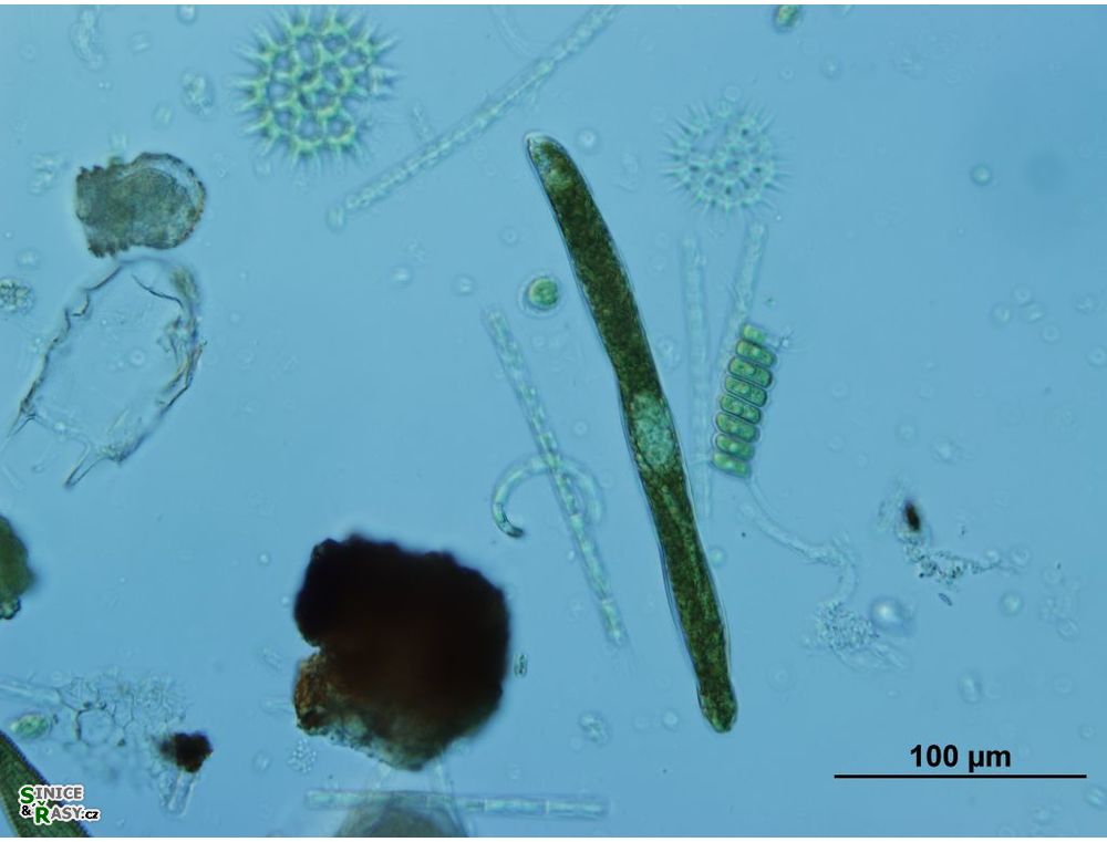 Euglena ehrenbergii