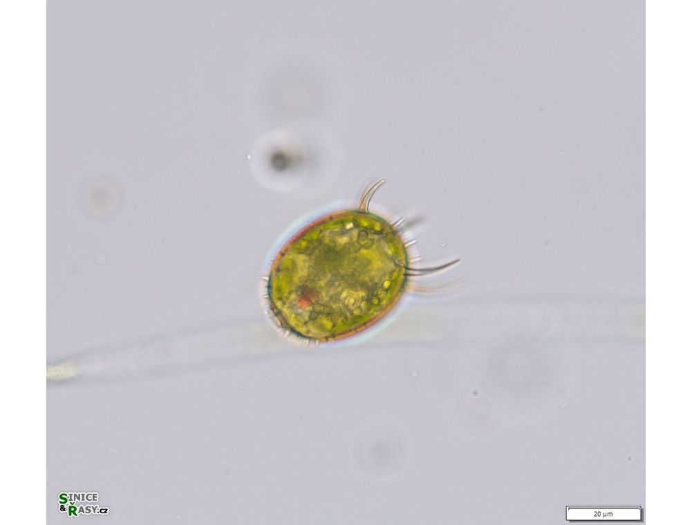 Trachelomonas armata