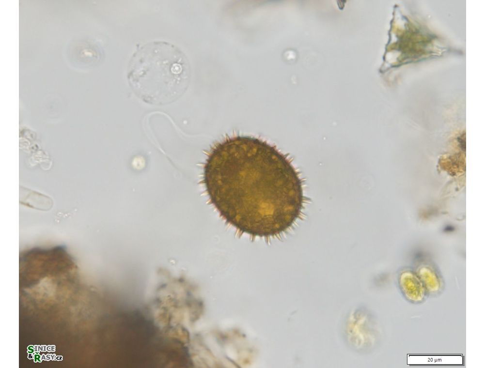 Trachelomonas superba