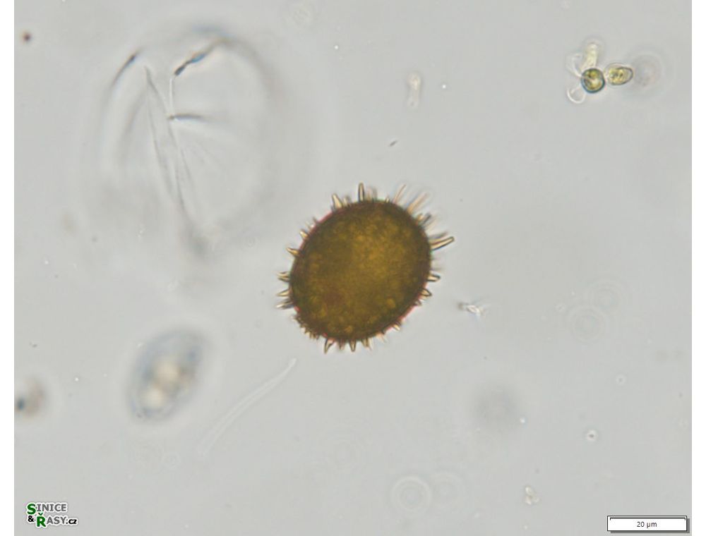 Trachelomonas superba
