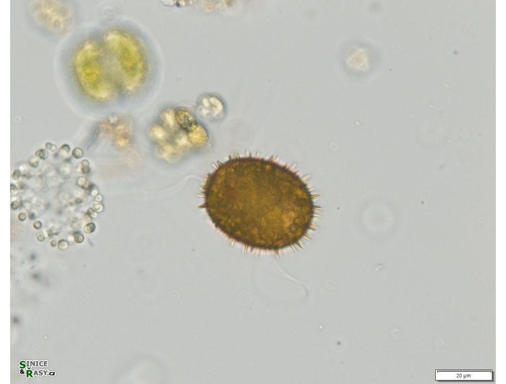 Trachelomonas superba