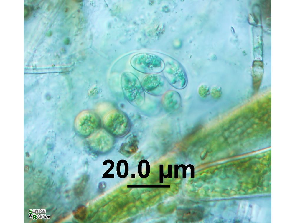 Glaucocystis nostochinearum