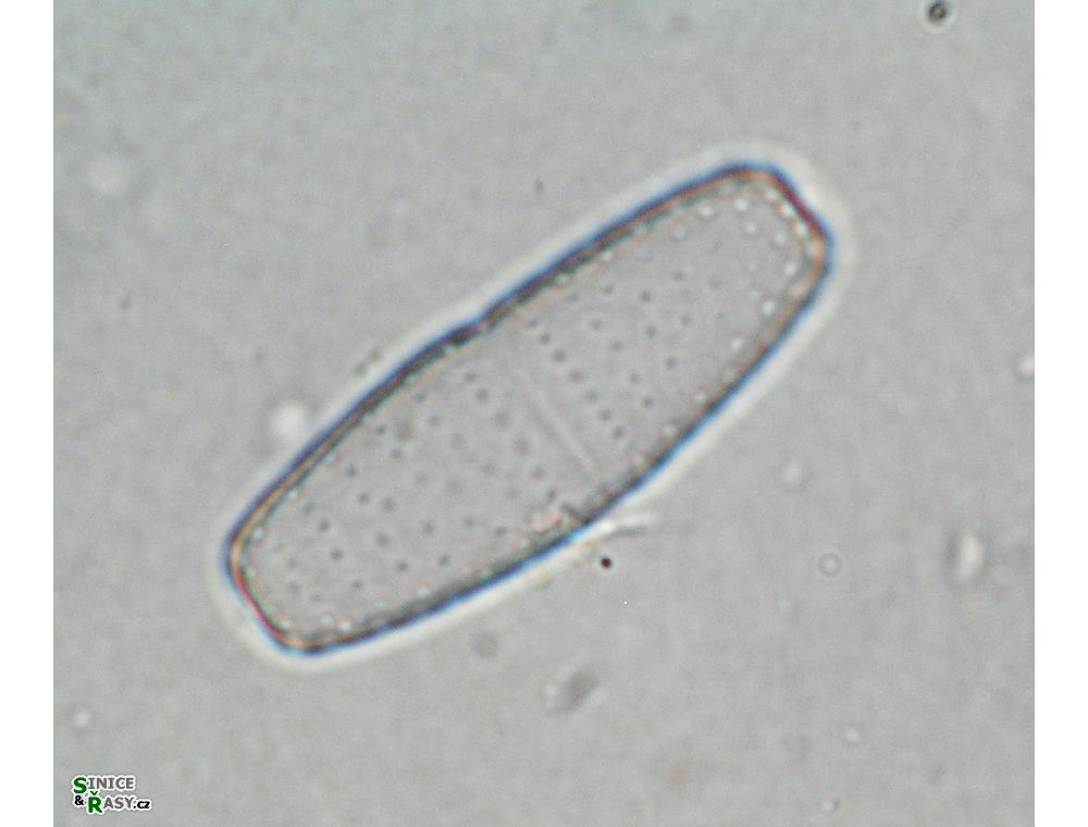 Actinotaenium adelochondrum
