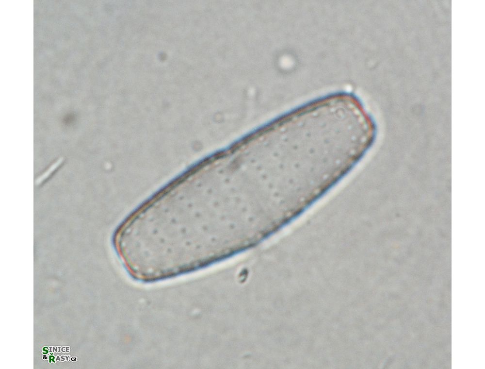 Actinotaenium adelochondrum