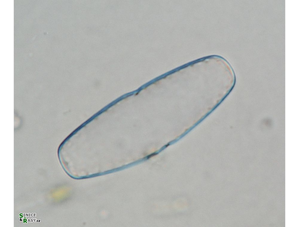 Actinotaenium adelochondrum