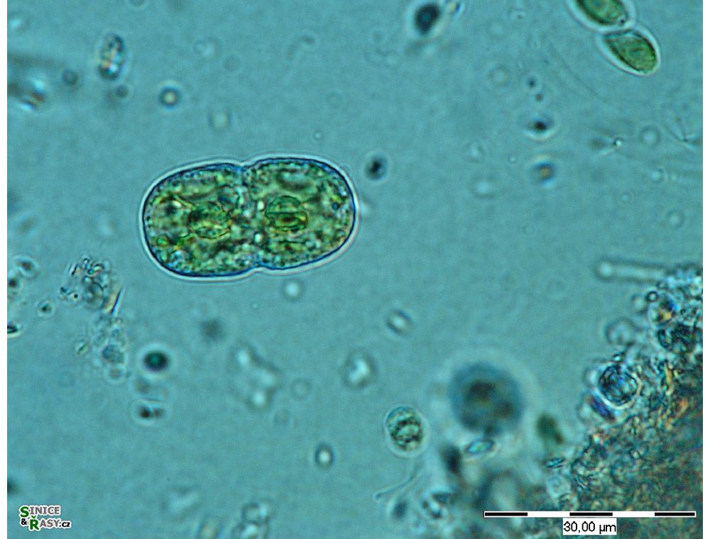 Actinotaenium cucurbita