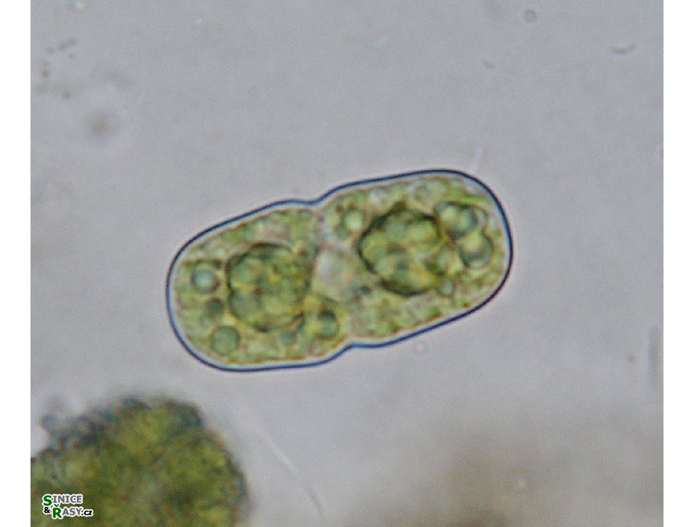 Actinotaenium cucurbita