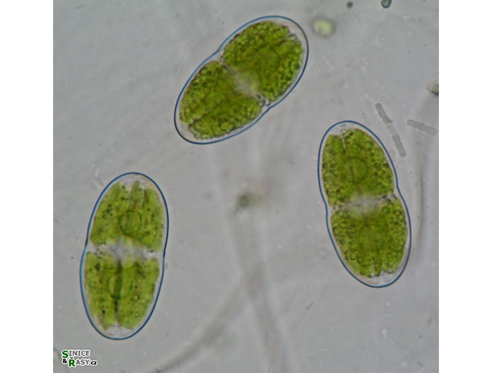 Actinotaenium curtum