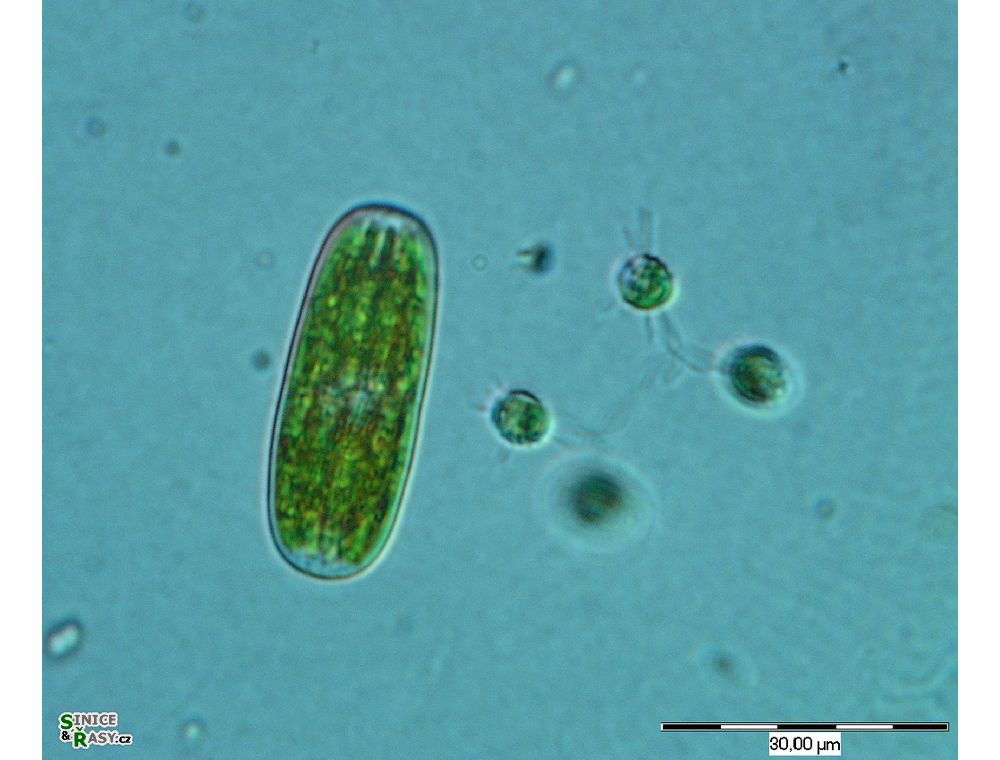 Actinotaenium