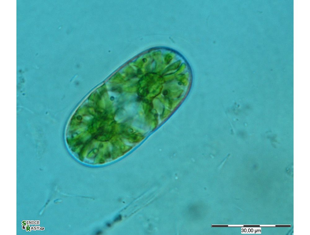 Actinotaenium diplosporum