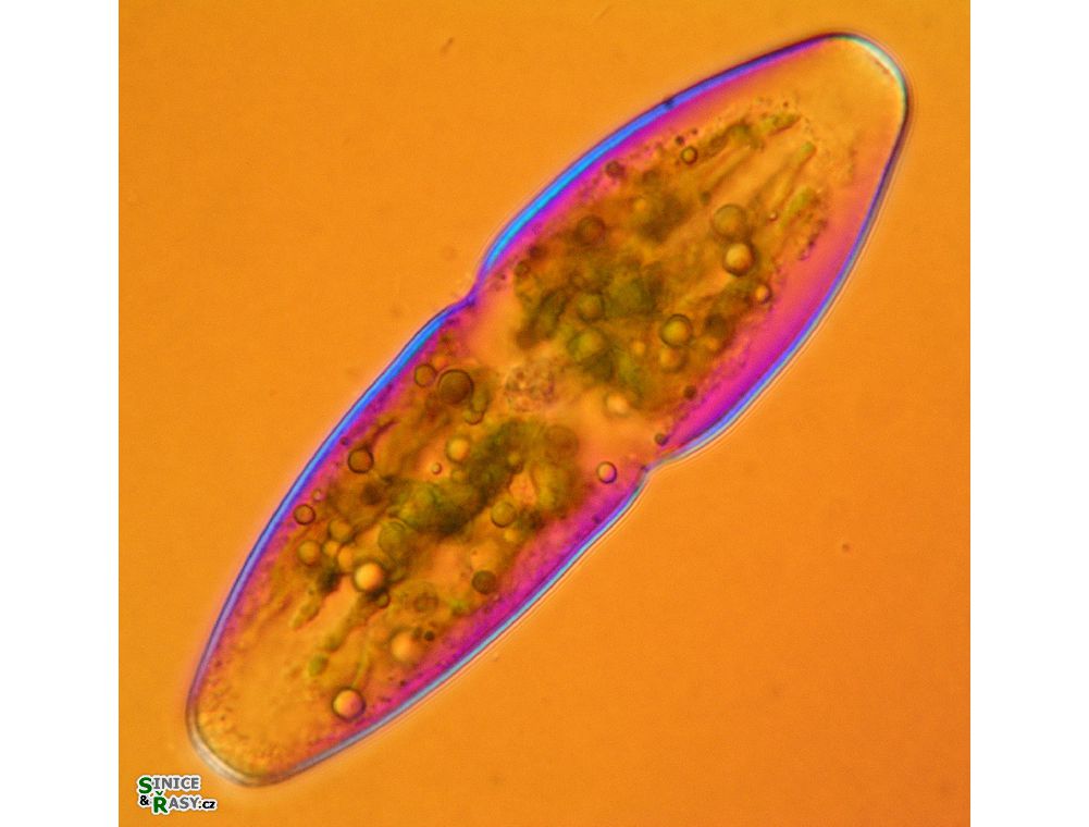 Actinotaenium elongatum
