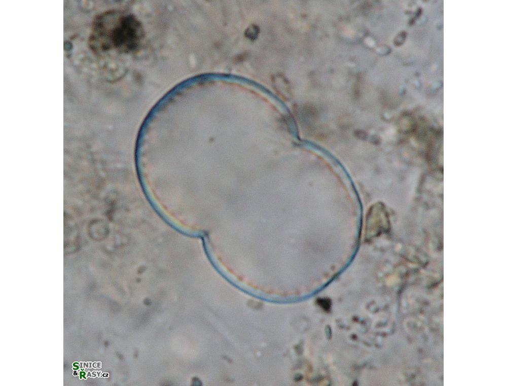 Actinotaenium globosum