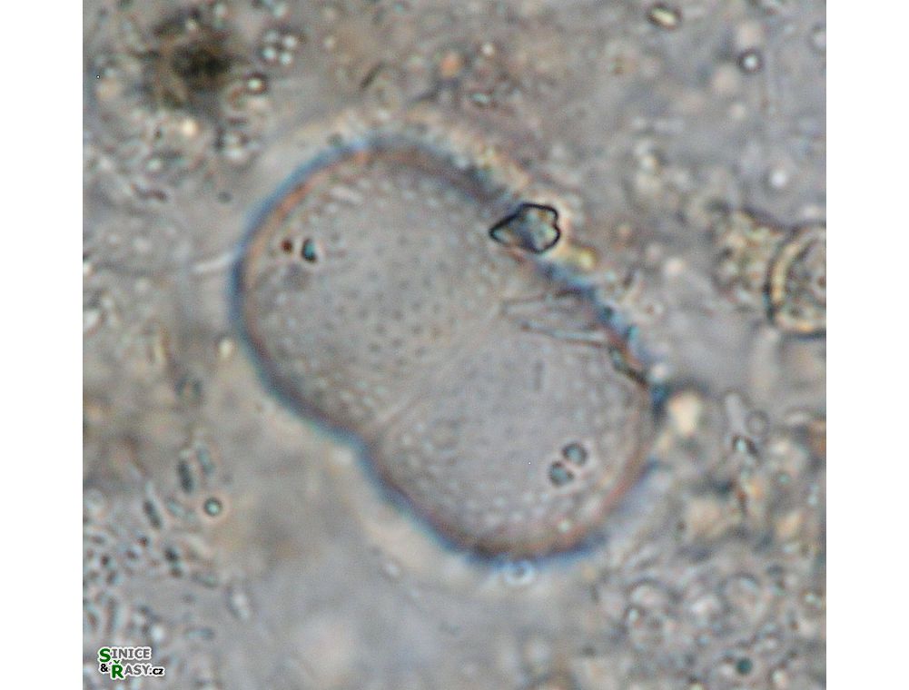 Actinotaenium globosum