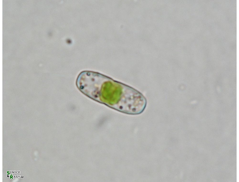 Actinotaenium inconspicuum