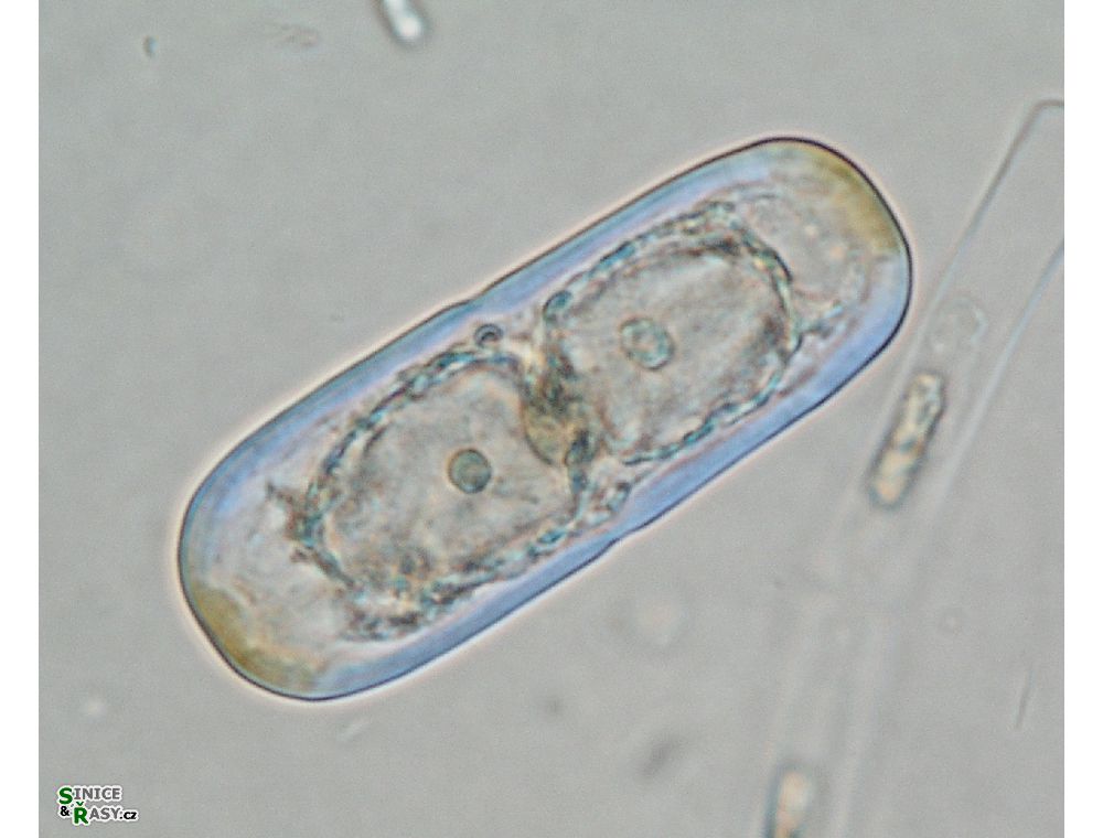 Actinotaenium silvae-nigrae