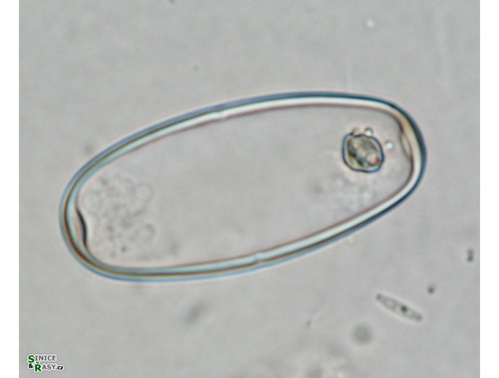 Actinotaenium