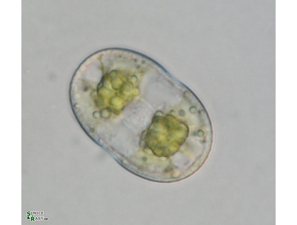 Actinotaenium wollei
