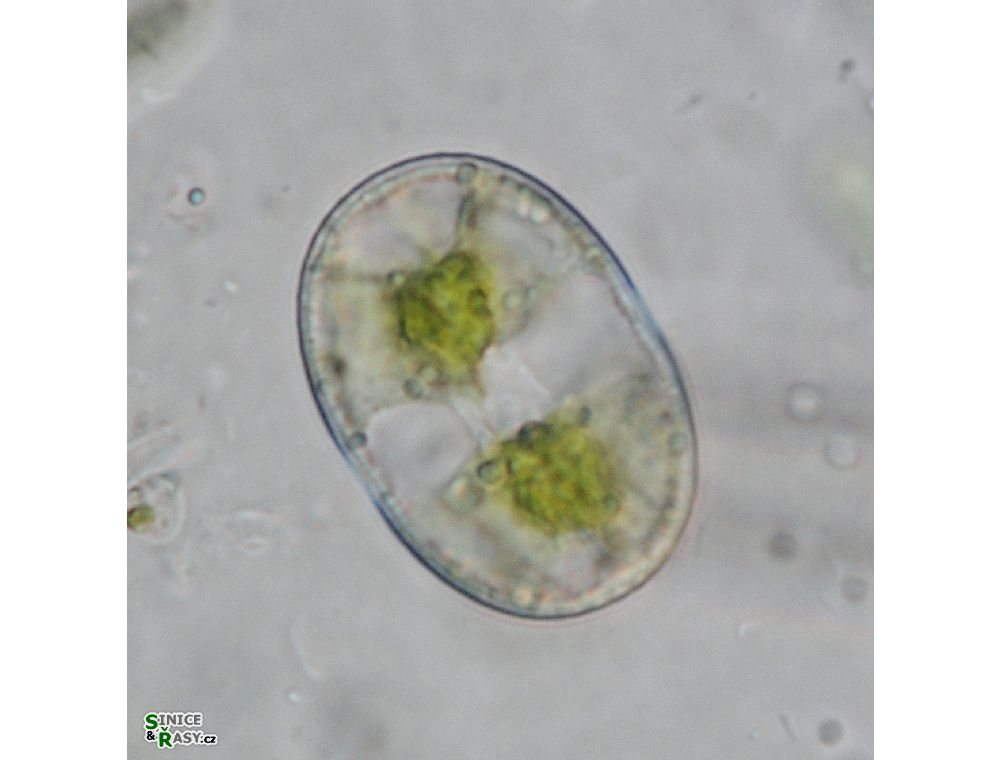 Actinotaenium wollei