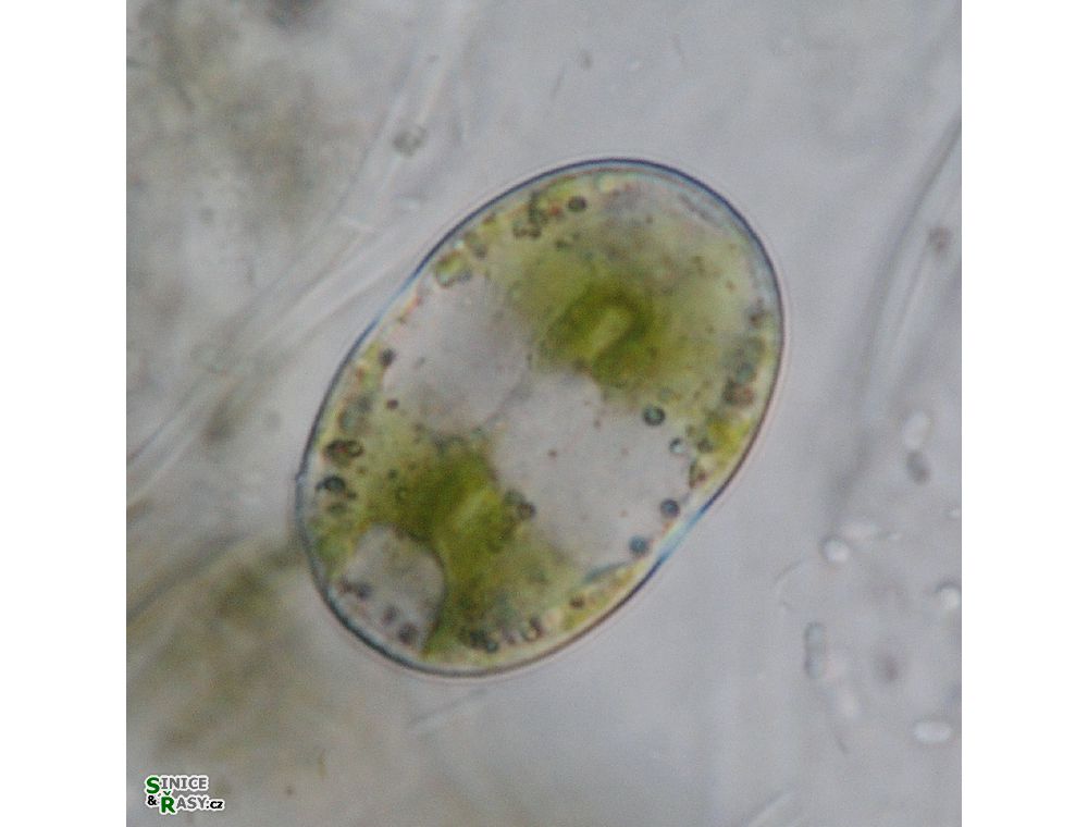 Actinotaenium wollei