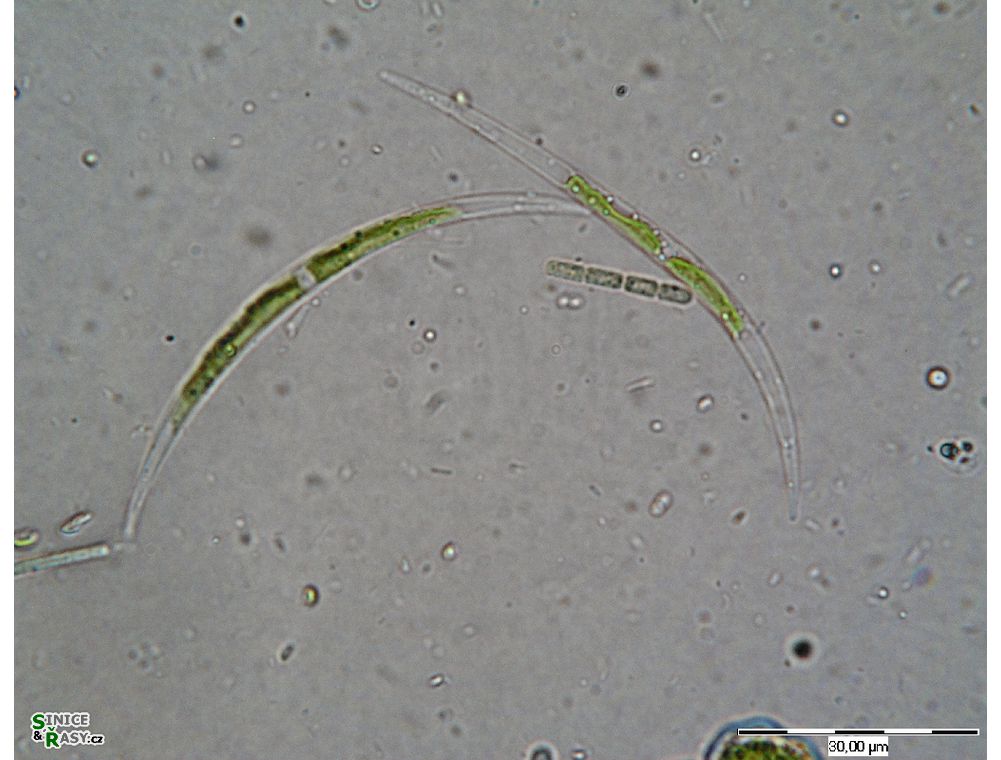 Closterium acutum