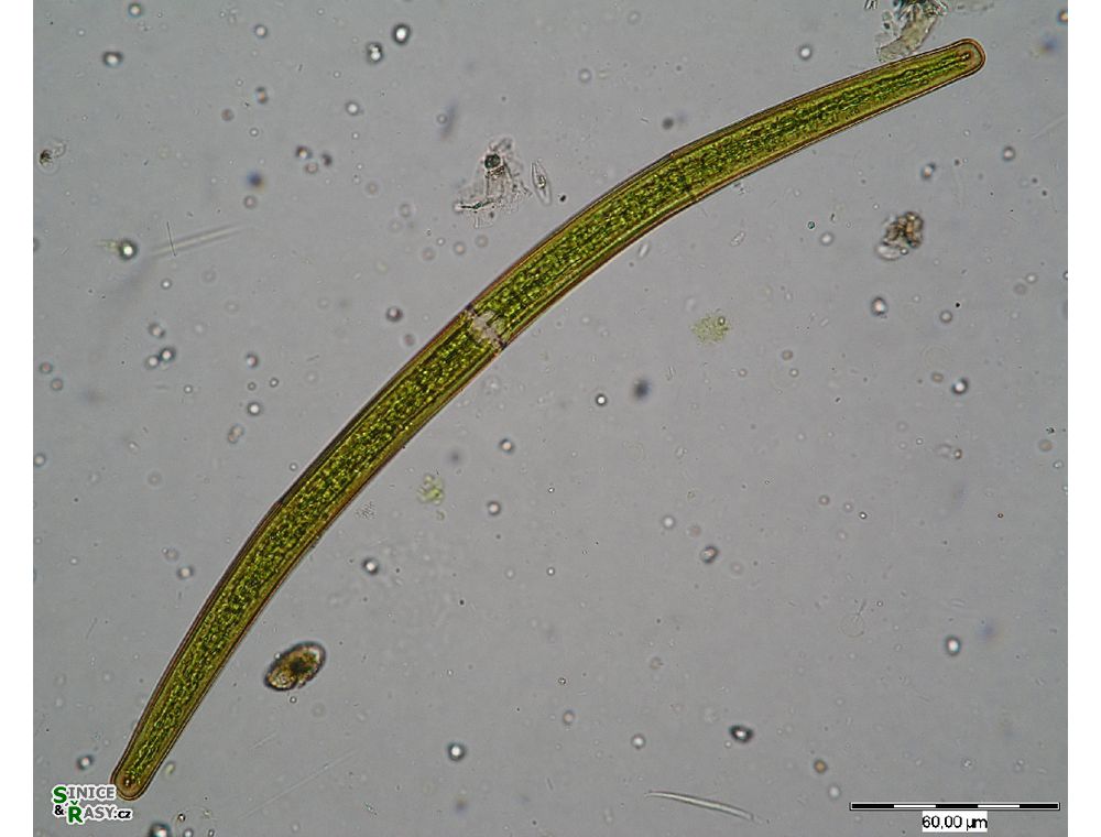 Closterium angustatum